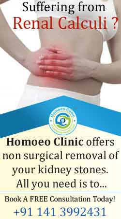 homoeopathic treatment for Renal Calculi
