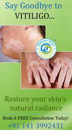 homoeopathic treatment for White-Patches