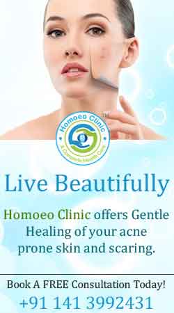 homoeopathic treatment for Acne