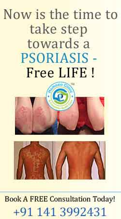 homoeopathic treatment for psoriasis