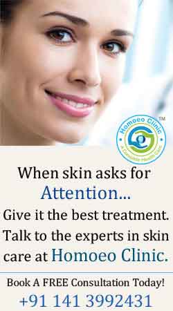 homoeopathic treatment for Skin Alliment